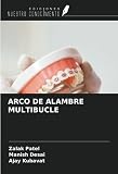 Arco de alambre: análisis y comparativa de los mejores modelos para ortodoncia