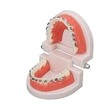 Modelo de Dientes para EnseñAnza, Modelo de Dientes de Ortodoncia, Tipodontos Modelo de Demostración de Ortodoncia con Alambres Metálicos y Soporte Enseñanza, Aprendizaje, Modelo de Interpretación