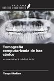 Tomografía dental: análisis y comparativa de los mejores equipos para cuidar tus dientes