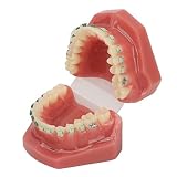 Modelo de cepillado de dientes, de Ortodoncia Profesional Modelo de Pantalla de Ortodoncia con Brackets Cerámicos y Brackets Metálicos para el Aprendizaje Investigación y Enseñanza de Odontología
