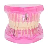 Ubric Modelo De Enseñanza Dental, Modelo Oral Desmontable Compatible Para Enseñanza, Investigación Y Laboratorios Dentales (Rosa)