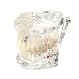 Modelo Dental de Demostración Transparente Desmontable, Fantoma Dental Estándar, Modelo Dental Transparente con Implantes y Dientes Extraíbles para Enseñanza de Patología Dental, Cuidado Bucal