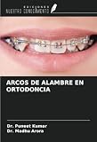 ARCOS DE ALAMBRE EN ORTODONCIA